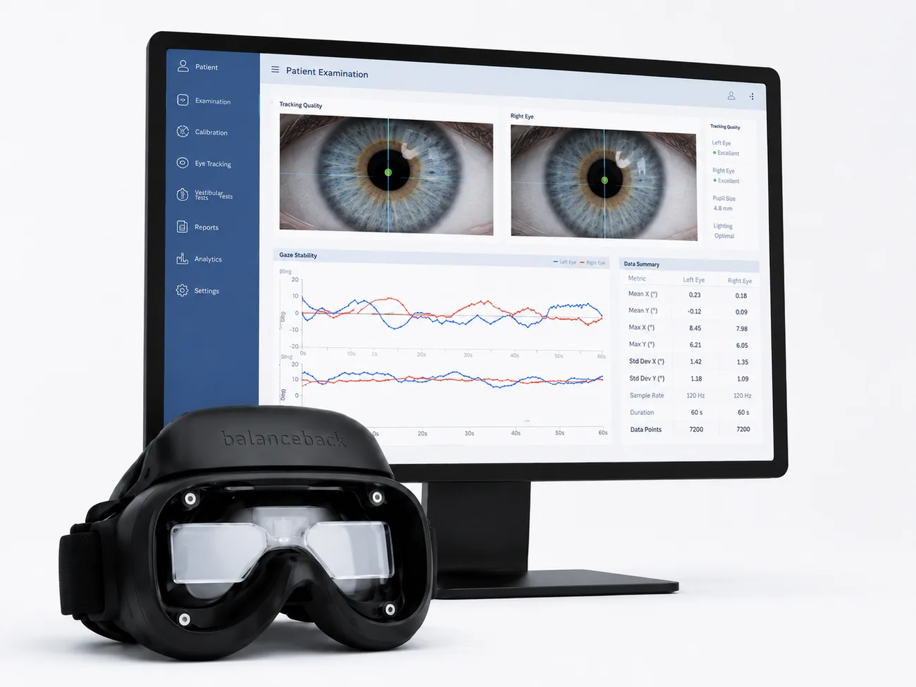The balanceback VNG goggles and dashboard software showing a patient examination